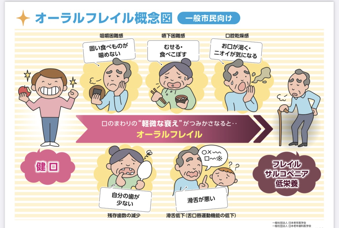 口腔機能が低下すると、食事はどう変わるのか